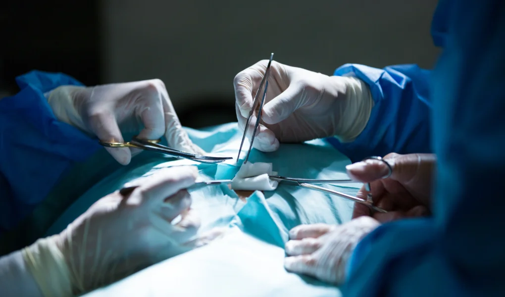 Laparoscopic Hernia Surgery in Kerala