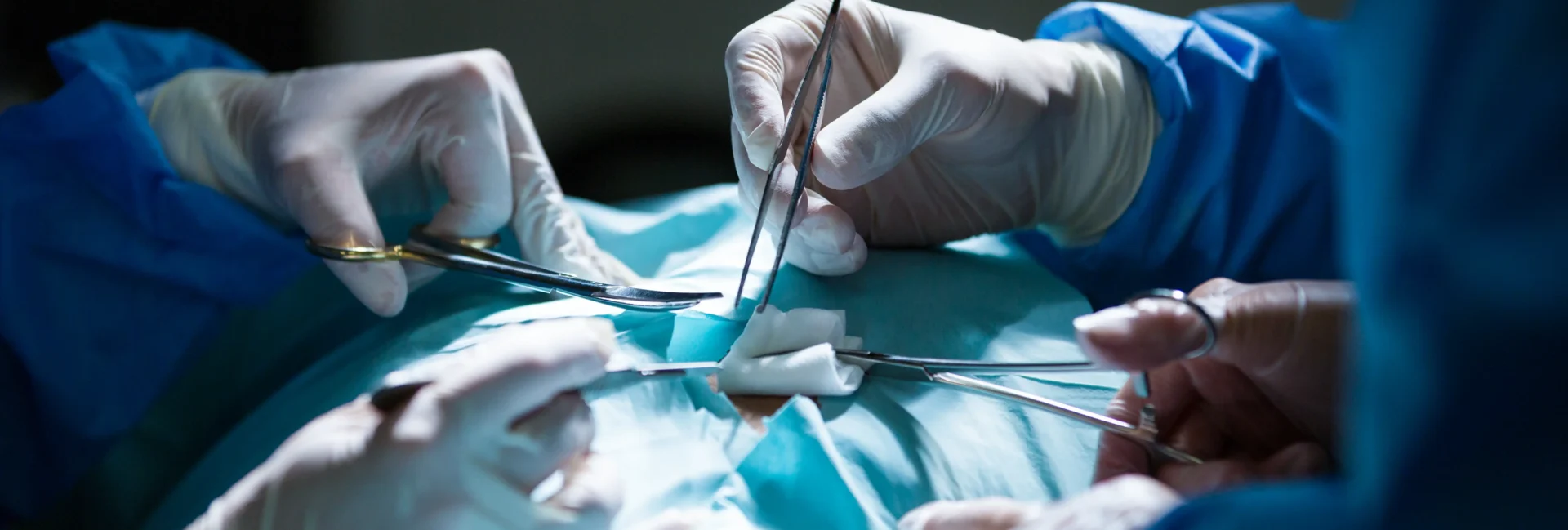 Laparoscopic Hernia Surgery in Kerala